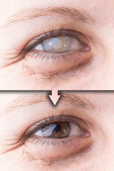 terre d ophatlmo associationdr camille rambaud ophthalmologist paris refractive surgery and cataract