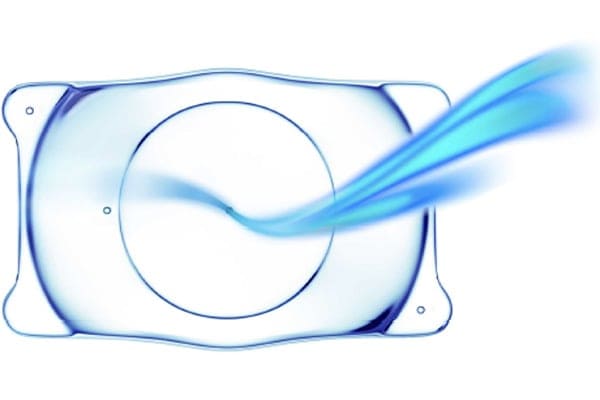 implantable collamer myopia lenses dr camille rambaud ophthalmologist paris refractive surgery and cataract