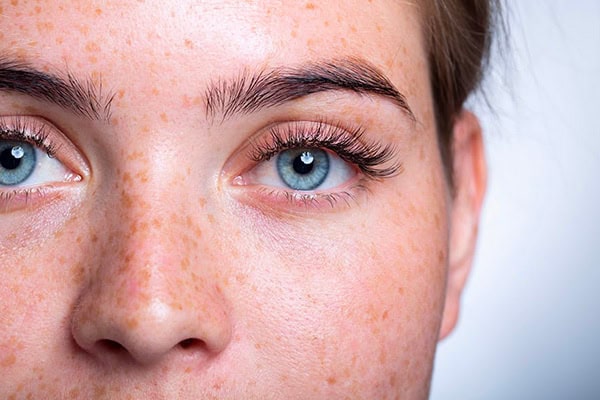 smile eye surgery dr camille rambaud ophthalmologist paris refractive surgery and cataract